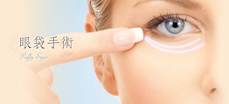 檔案:Surgery Eye-EyeBag-Cover.jpg
